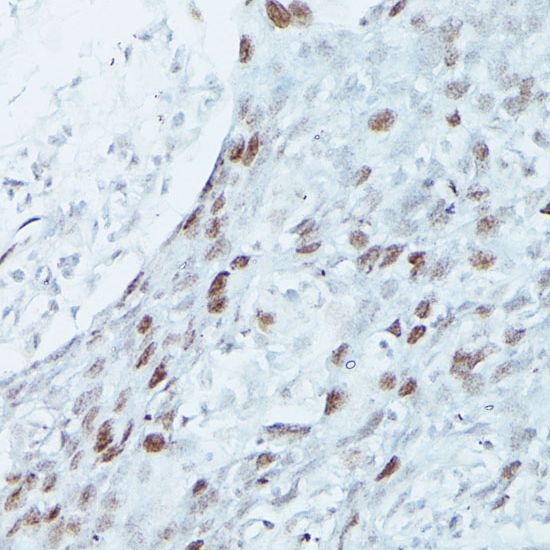 MEF2C antibody