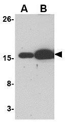 Bim antibody [1C2C8]