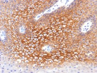 gamma Catenin antibody [CTNG/1483]
