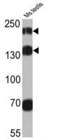 Proteosome Activator, 200 kDa antibody