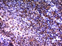 NuMA antibody [A73-B/D12]