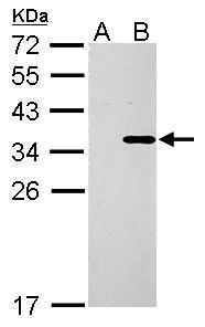 COL11A2 antibody