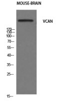 Versican antibody