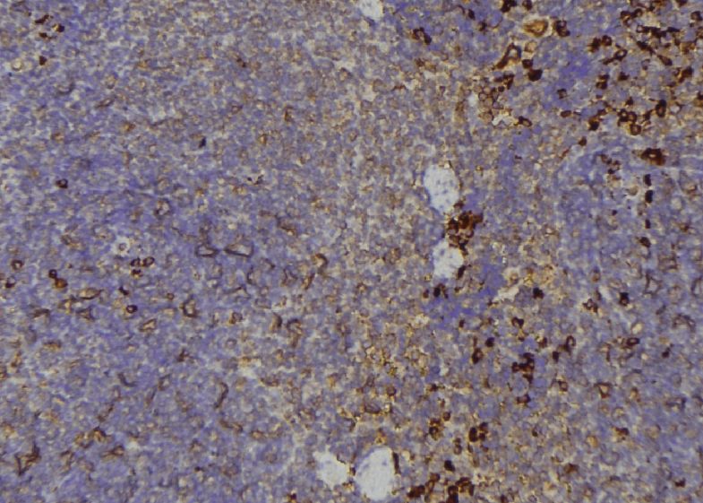 TIE2 (phospho Tyr992) antibody