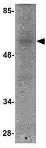 RNF168 antibody