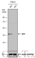 MPI antibody