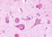 Latrophilin 3 antibody