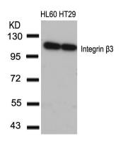 Integrin beta 3 antibody