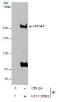 ATG2A antibody