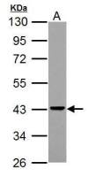Adenosine Deaminase antibody