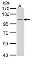 Polycystin 2 antibody