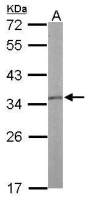 Tropomyosin 1 antibody