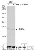 RAB7A antibody