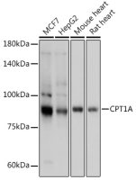 CPT1A antibody