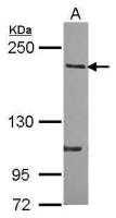 p190-B RhoGAP antibody