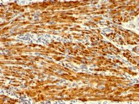 Calponin 1 antibody [SPM169]