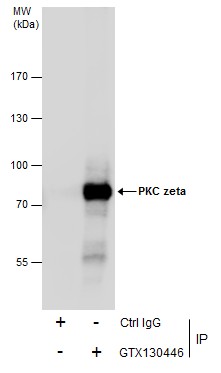 PKC zeta antibody
