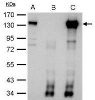 CIZ1 antibody [N2C1], Internal