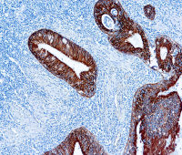 pan Cytokeratin antibody [AE1/AE3]