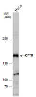 CFTR antibody