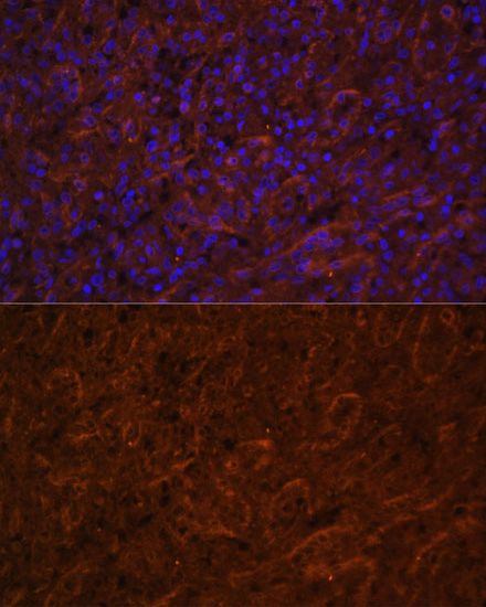 ICOS antibody