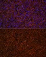ICOS antibody