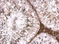 KLHL25 antibody [C1C3]