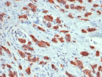 MUC1 antibody [MUC1/1887R]