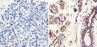 MMP2 antibody [MMP2/2C1-1D12]