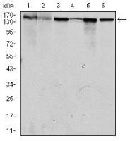MSH6 antibody [3E1]