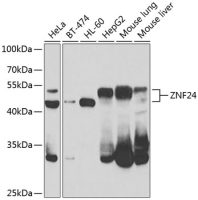 ZNF24 antibody