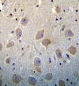 Pleiotrophin antibody, N-term
