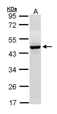 HPD antibody [N1C2]