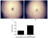 Human TNF Receptor I protein, His and GST tag (active)