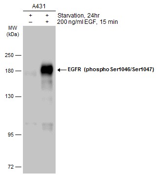 EGFR (phospho Ser1046/Ser1047) antibody