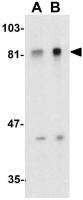 ADAM10 antibody