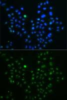 Nucleostemin antibody