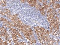 Podoplanin antibody [IHC650]