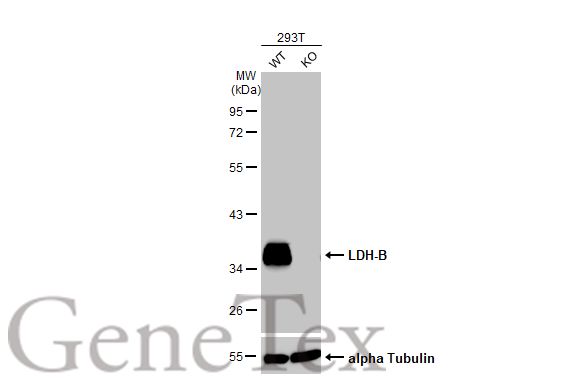 LDH-B antibody