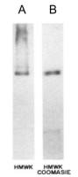 HMW Kininogen antibody [2B5]