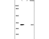 TACI antibody