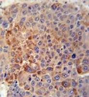 GPLD1 antibody, C-term