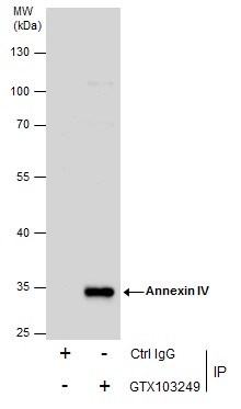 Annexin IV antibody