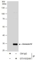 Annexin IV antibody