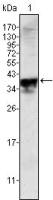 Androgen Receptor antibody [2H8]
