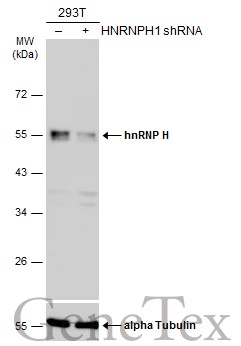 hnRNP H antibody [N1C1]
