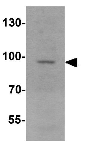JAKMIP2 antibody
