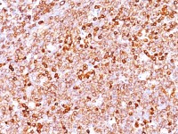 CD79a antibody [IGA/1688R]