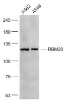 RBM20 antibody