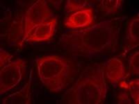 Her3 / ErbB3 (phospho Tyr1328) antibody